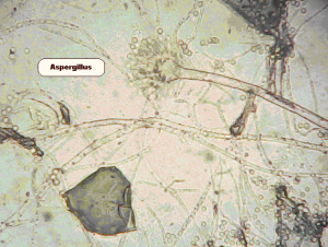 Immature Aspergillus fruiting body